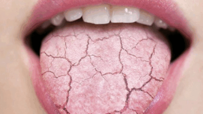 BREAKING: Your Blood Sugar Is High If You Feel The Following Symptoms