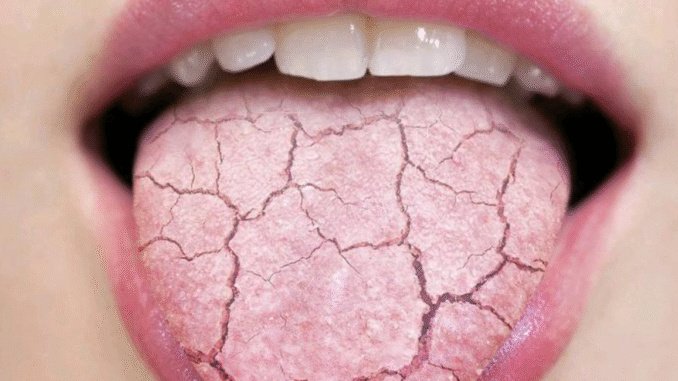 BREAKING: Your Blood Sugar Is High If You Feel The Following Symptoms BREAKING: Your Blood Sugar Is High If You Feel The Following Symptoms