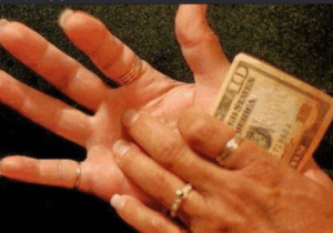 BREAKING NEWS: Itchy Palms Does Not Call For Money; Here Is What It Means About Your Health