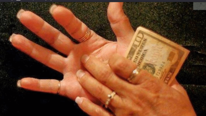 BREAKING NEWS: Itchy Palms Does Not Call For Money; Here Is What It Means About Your Health