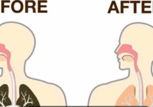 EXCLUSIVE: All smokers, do the following things to detox all the nicotine in your body