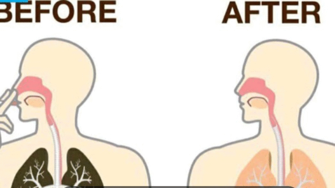 EXCLUSIVE: All smokers, do the following things to detox all the nicotine in your body EXCLUSIVE: All smokers, do the following things to detox all the nicotine in your body