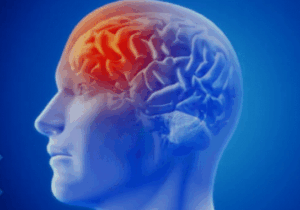 BREAKING: If You Don’t Want to Suffer Stroke at Old Age, Avoid Excess Intake of These three Things