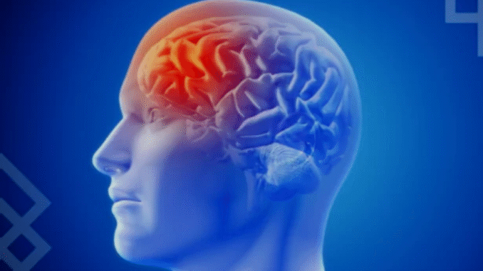 BREAKING: If You Don’t Want to Suffer Stroke at Old Age, Avoid Excess Intake of These three Things