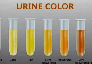 BREAKING: Why does your urine change colour? Here’s what it means