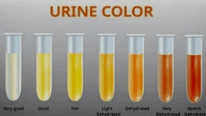 BREAKING: Why does your urine change colour? Here’s what it means