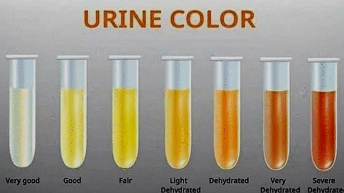 BREAKING: Why does your urine change colour? Here’s what it means