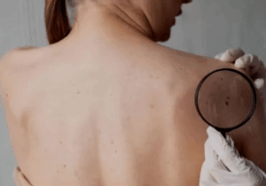 BREAKING: If Any of These Three Symptoms Appear on Your Body, Cancer Is Trying to Attack