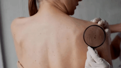 BREAKING: If Any of These Three Symptoms Appear on Your Body, Cancer Is Trying to Attack