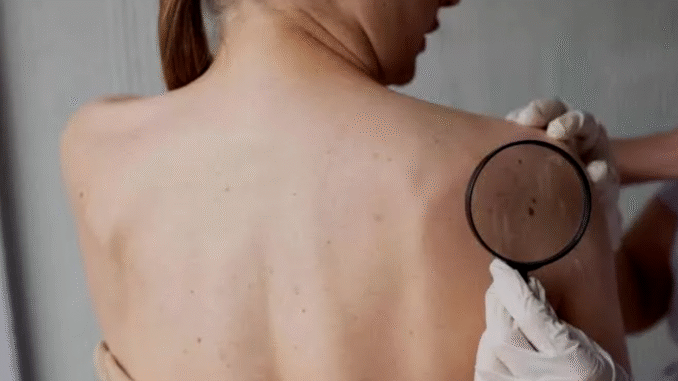 BREAKING: If Any of These Three Symptoms Appear on Your Body, Cancer Is Trying to Attack BREAKING: If Any of These Three Symptoms Appear on Your Body, Cancer Is Trying to Attack