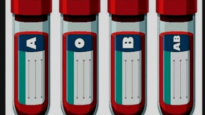 BREAKING NEWS: If You Fall in Blood Group O, Avoid These Habits and You Will Live Longer