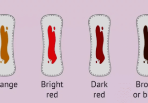 What every colour of your menstrual blood says about your health