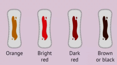 What every colour of your menstrual blood says about your health