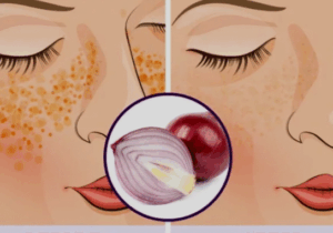 BREAKING NEWS: Why Men and Women Should Rub Onions on Their Face