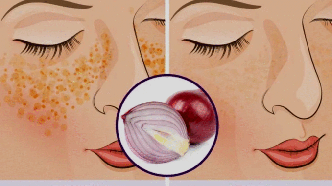 BREAKING NEWS: Why Men and Women Should Rub Onions on Their Face