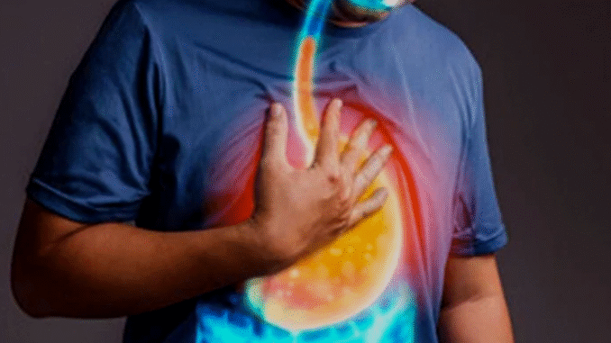 BREAKING: If You Are Troubled by Acidity and Stomach Heaviness, Consume These 4 Things for Relief