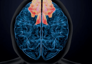 BREAKING NEWS: You Are Slowly Killing Your Brain If You Keep Doing These Five Things