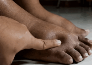 BREAKING: Here’s what causes pregnant women’s feet to swell