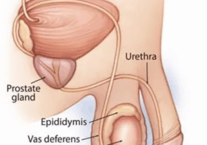 How much do you know about testicular cancer? (DETAILS)