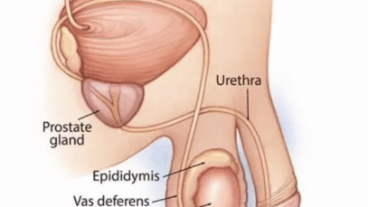 How much do you know about testicular cancer? (DETAILS)