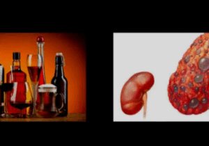 Five 5 drinks that can damage the kidneys