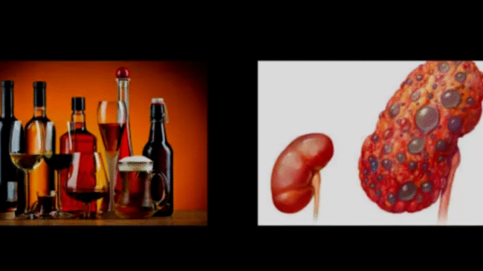 Five 5 drinks that can damage the kidneys