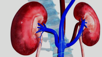 BREAKING: How artificial sweeteners fuel diabetes, damage kidney, say experts
