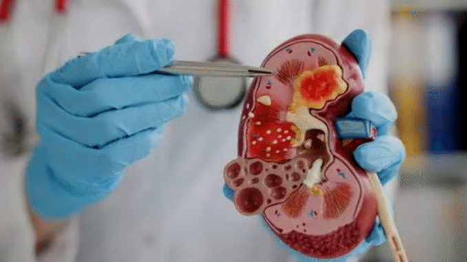 5 Signs Of Swollen Kidneys That Should Not Be Ignored
