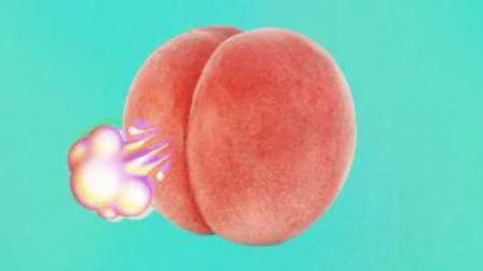 JUST-IN: Why you fart all the time and how to stop it