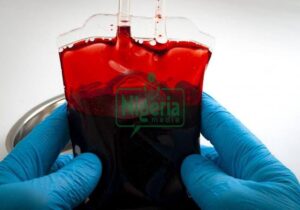 If You Fall In Blood Group O, Avoid These Habits And You Will Live Longer (DETAILS)