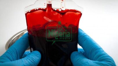 If You Fall In Blood Group O, Avoid These Habits And You Will Live Longer (DETAILS)