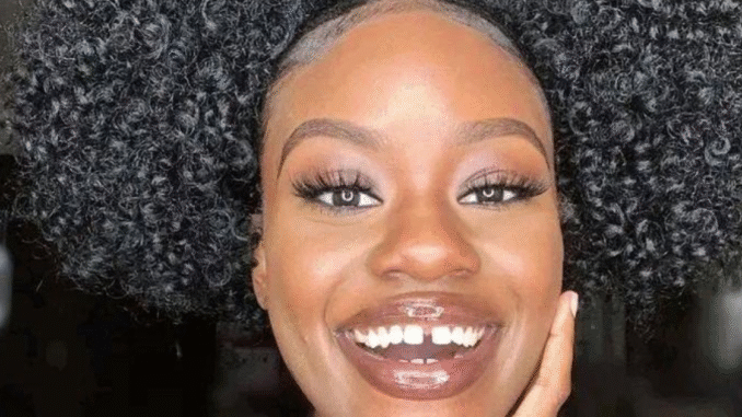 BREAKING: Stop Calling it ‘Gap Teeth’ or ‘Open Teeth’ Here is the Correct Word to Say and Other Health Facts
