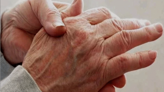 Parts Of The Body You Will Feel Tingling And Pain Due to High Blood Sugar Level