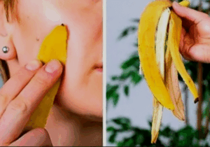 5 amazing benefits of banana peel you should know