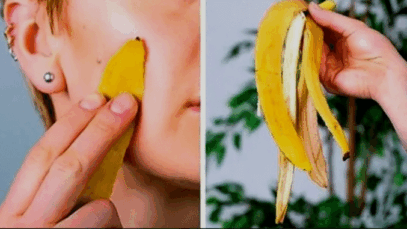 5 amazing benefits of banana peel you should know