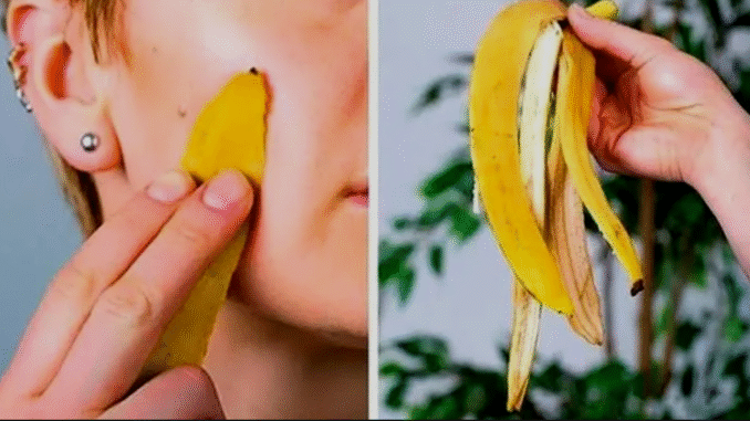 5 amazing benefits of banana peel you should know