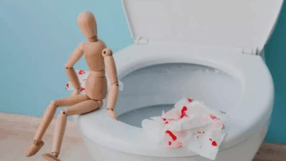 5 reasons you might see blood in your poop