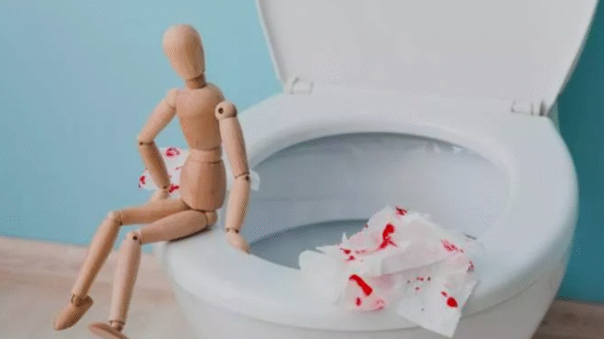 5 reasons you might see blood in your poop