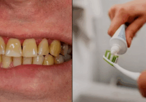 Dentist shares the seven main reasons your teeth go yellow and ways to stop it happening