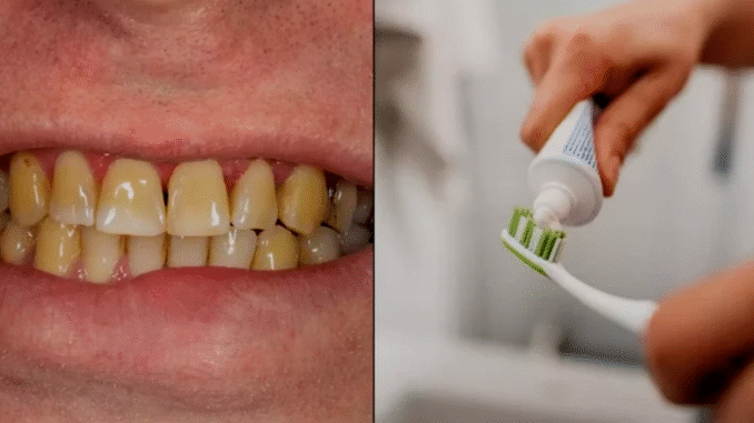 Dentist shares the seven main reasons your teeth go yellow and ways to stop it happening