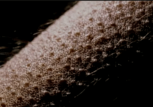 Do you have goosebumps in hot weather? Here’s why it could be dangerous