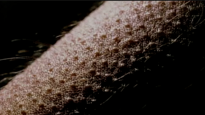Do you have goosebumps in hot weather? Here’s why it could be dangerous Do you have goosebumps in hot weather? Here’s why it could be dangerous