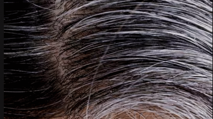 Say Goodbye to White Hair with These Natural Remedies Say Goodbye to White Hair with These Natural Remedies