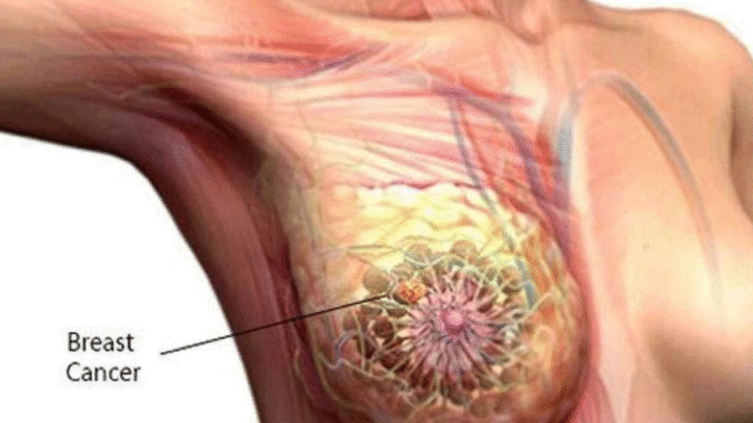 BREAKING: Ladies, Never Ignore These Early Symptoms. They Can Be a Serious Sign For the Following Disease BREAKING: Ladies, Never Ignore These Early Symptoms. They Can Be a Serious Sign For the Following Disease