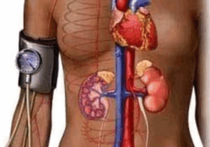 Symptoms Of High Blood Pressure