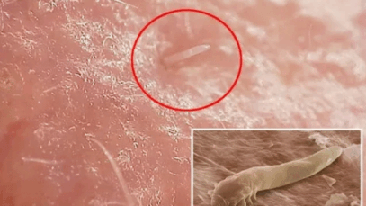 Are You Aware That During Sleep, a lot of Small Organism Comes out From Your Face? View Organisms Below!!!!