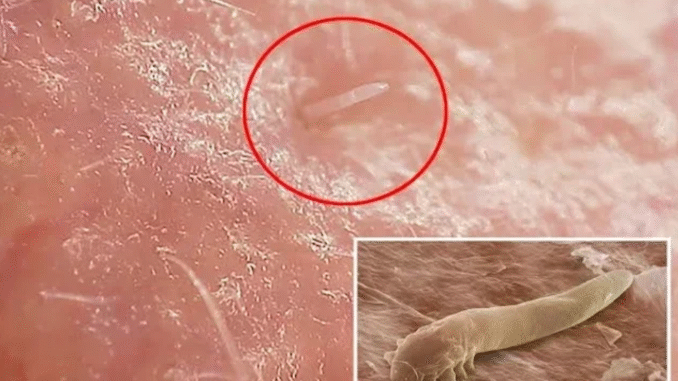 Are You Aware That During Sleep, a lot of Small Organism Comes out From Your Face? View Organisms Below!!!!