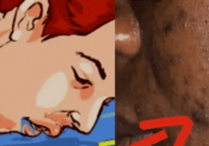 7 Things That Cause Pimples You Need To Stop Doing
