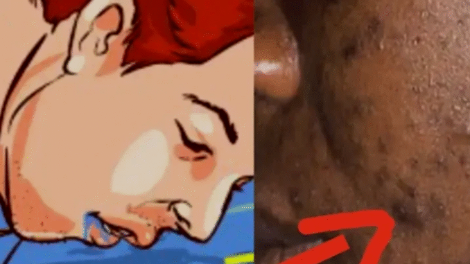 7 Things That Cause Pimples You Need To Stop Doing 7 Things That Cause Pimples You Need To Stop Doing