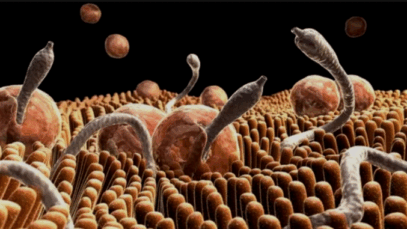 8 shocking things that happen when you don’t deworm your intestines